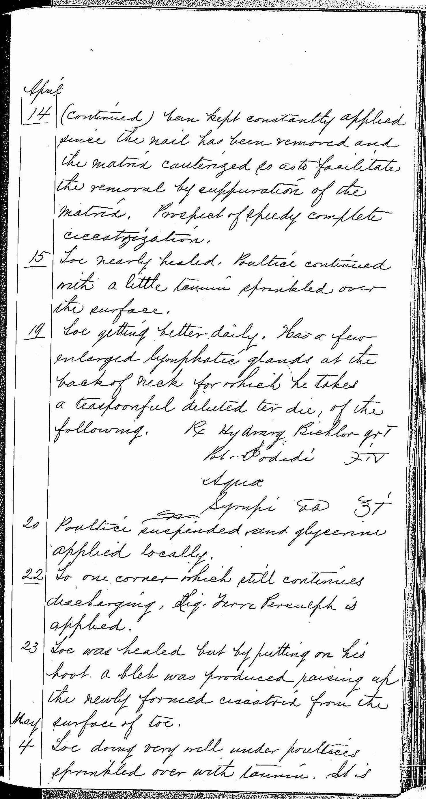 Entry for Robert S. Anderson (page 13 of 15) in the log Hospital Tickets and Case Papers - Naval Hospital - Washington, D.C. - 1868-69